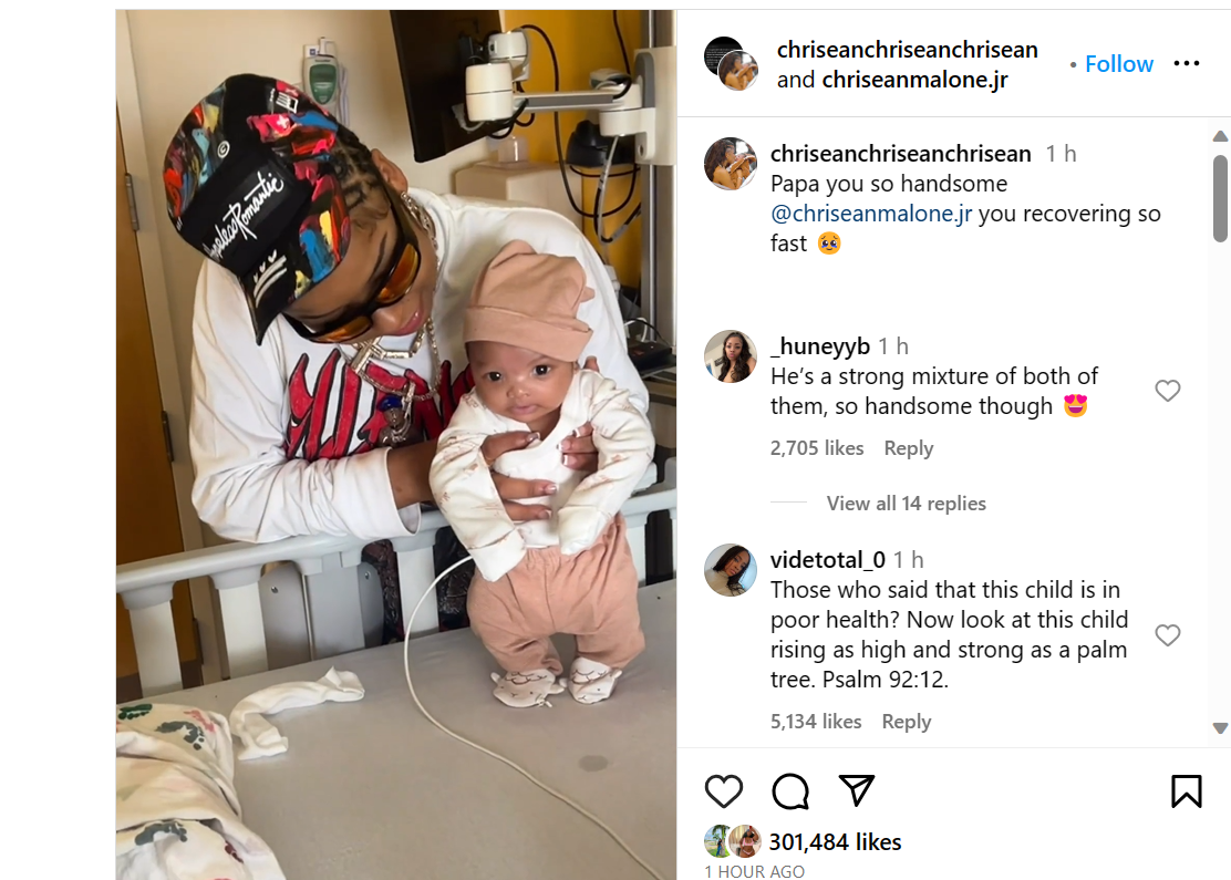 Chrisean Rock and Blueface’s son undergoes successful hernia surgery